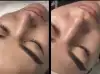 Photo 2 de Peeling - La Perla Esthétique
