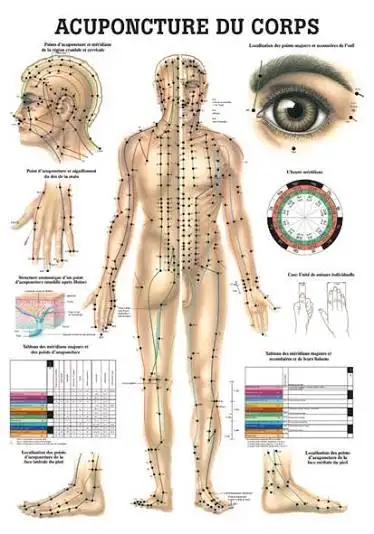 Photo 1 de Acupuncture chez Belle et Mince 